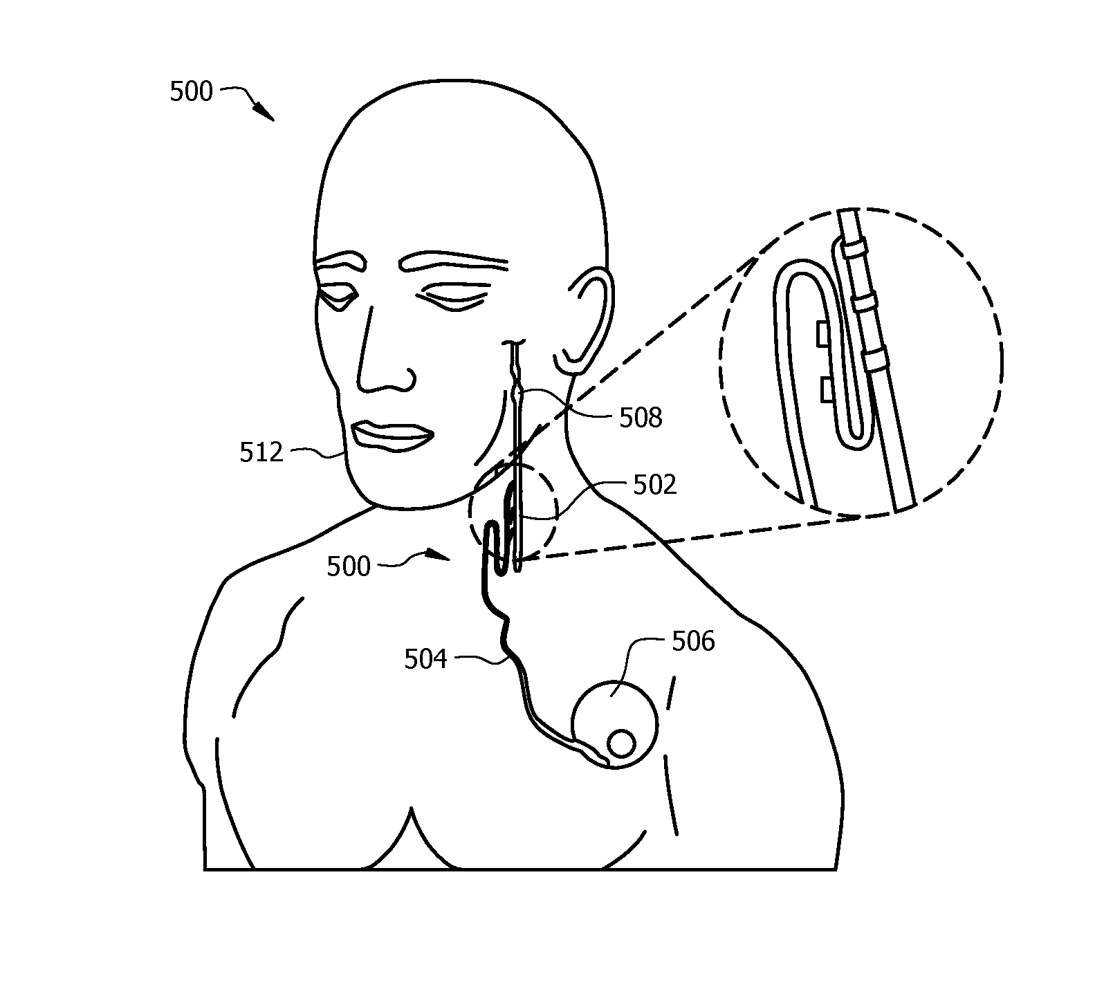 Methods, systems, and devices for pairing vagus nerve stimulation with motor therapy in stroke patients