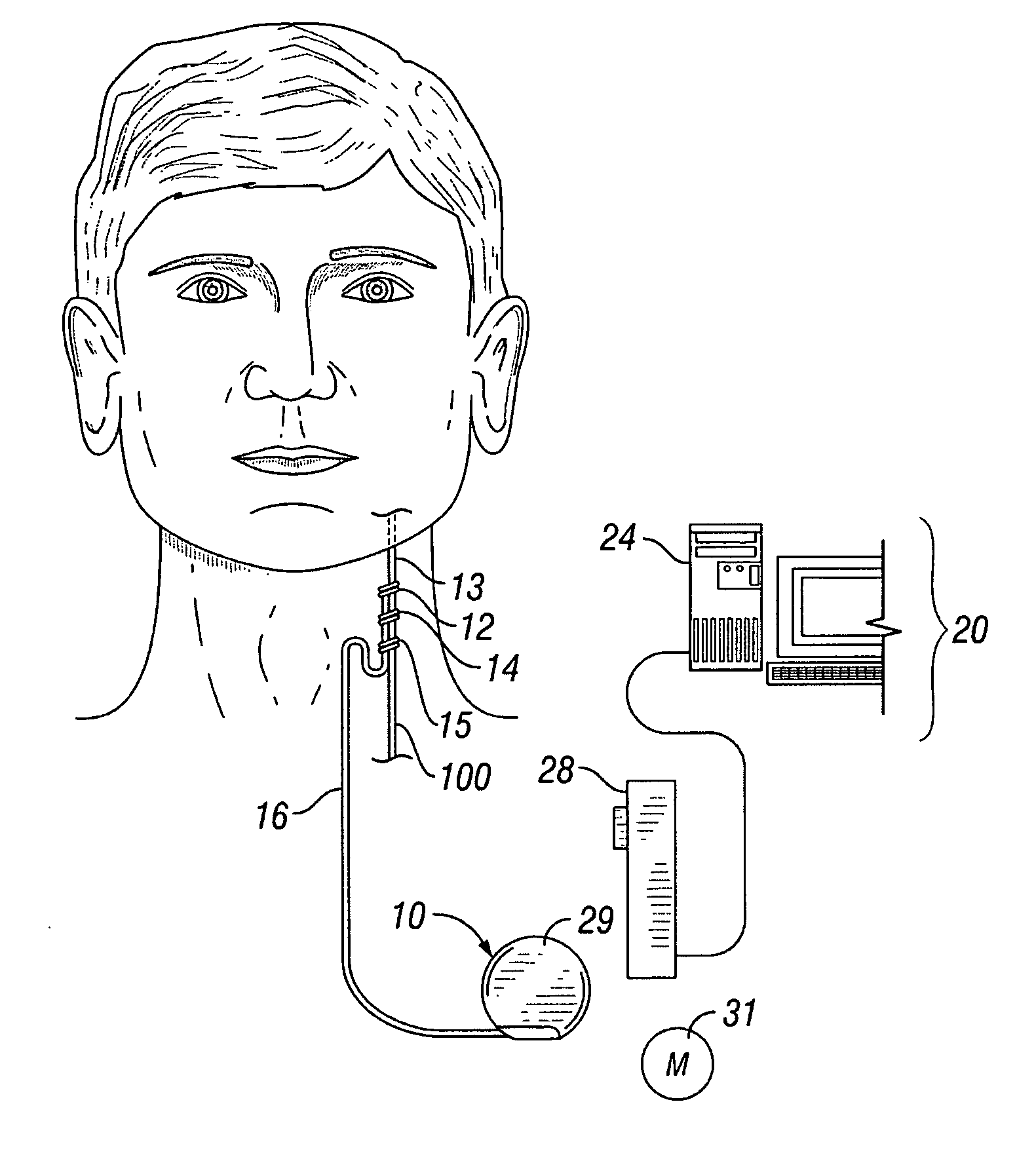 Sequenced therapy protocols for an implantable medical device