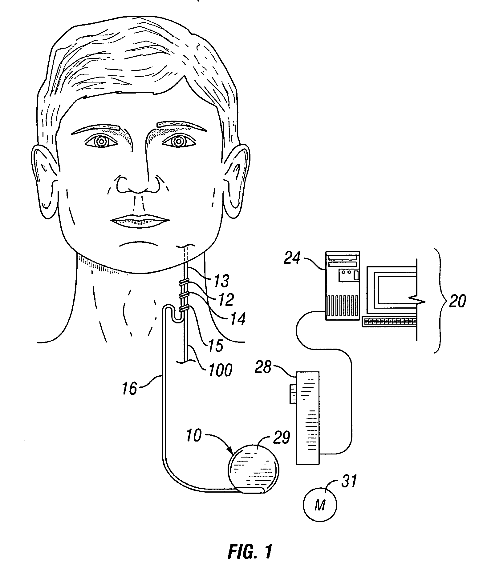 Sequenced therapy protocols for an implantable medical device