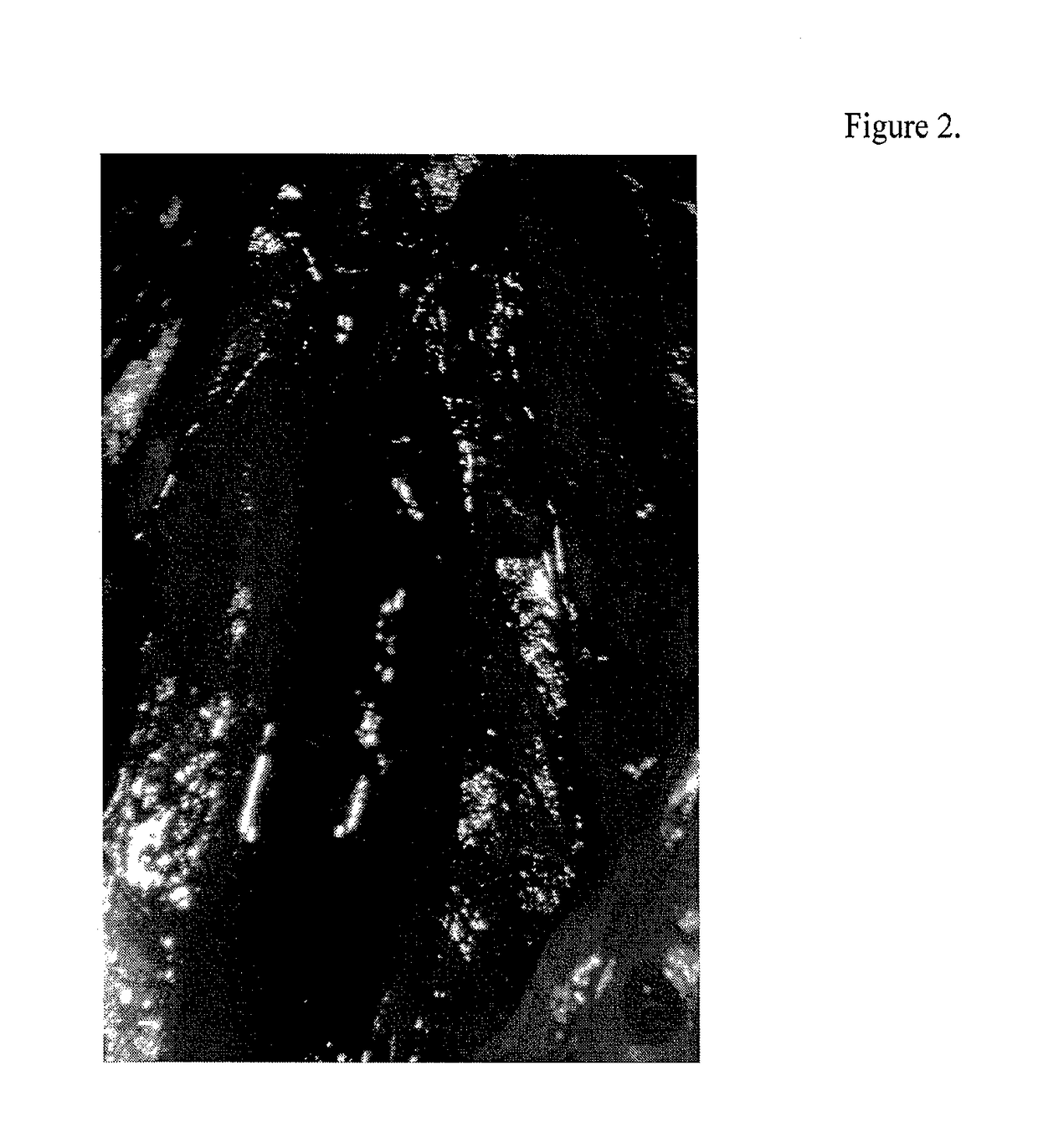 Accelerating thrombus resolution through augmentation of p53 activity