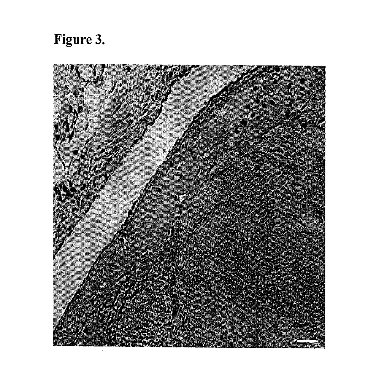 Accelerating thrombus resolution through augmentation of p53 activity