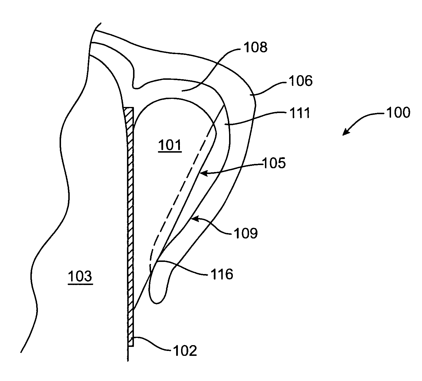 Systems and methods for improved engagement between aligners and teeth