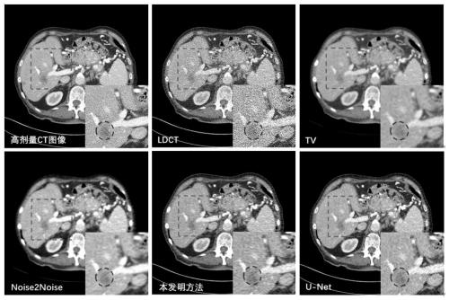 Low-dose CT image denoising method and system based on self-supervised learning