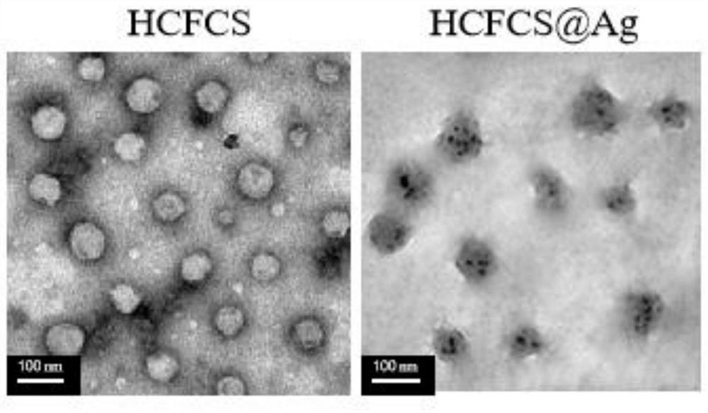 Targeted chitosan nano-silver gel as well as preparation method and application thereof