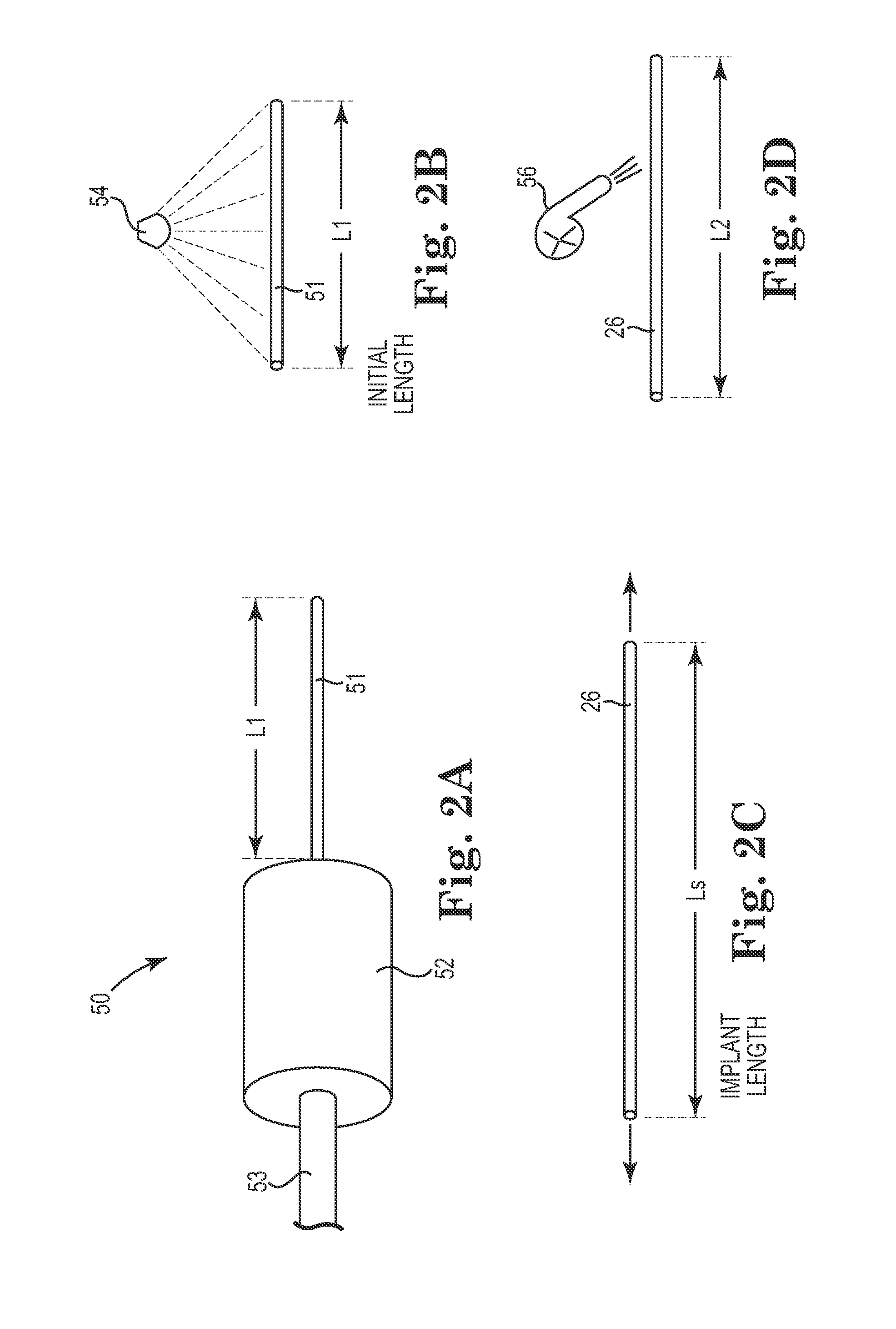 Method of treating incontinence