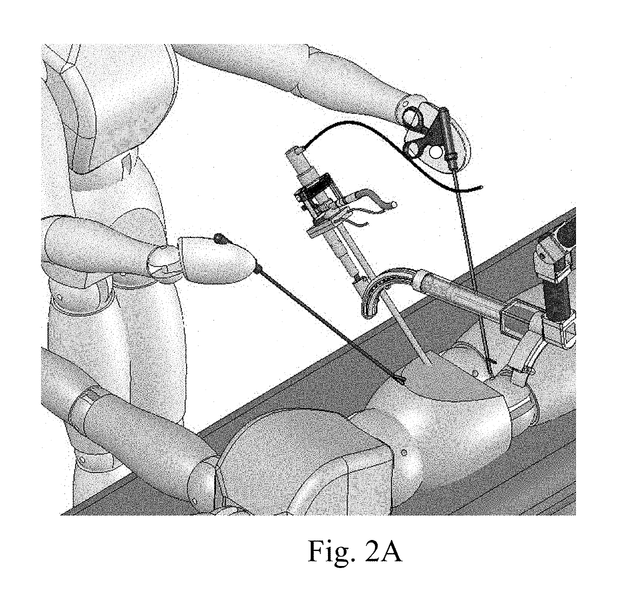 Device and method for assisting laparoscopic surgery—rule based approach