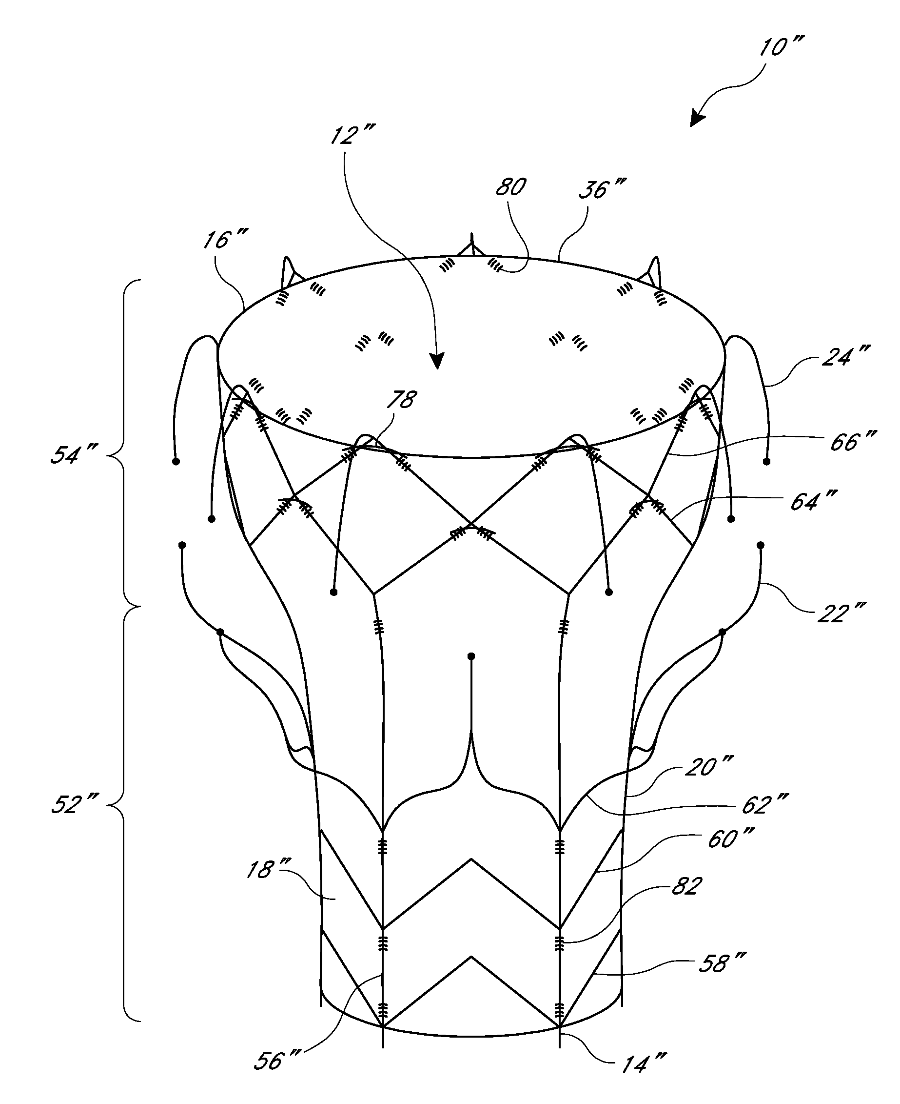 Replacement heart valves, delivery devices and methods