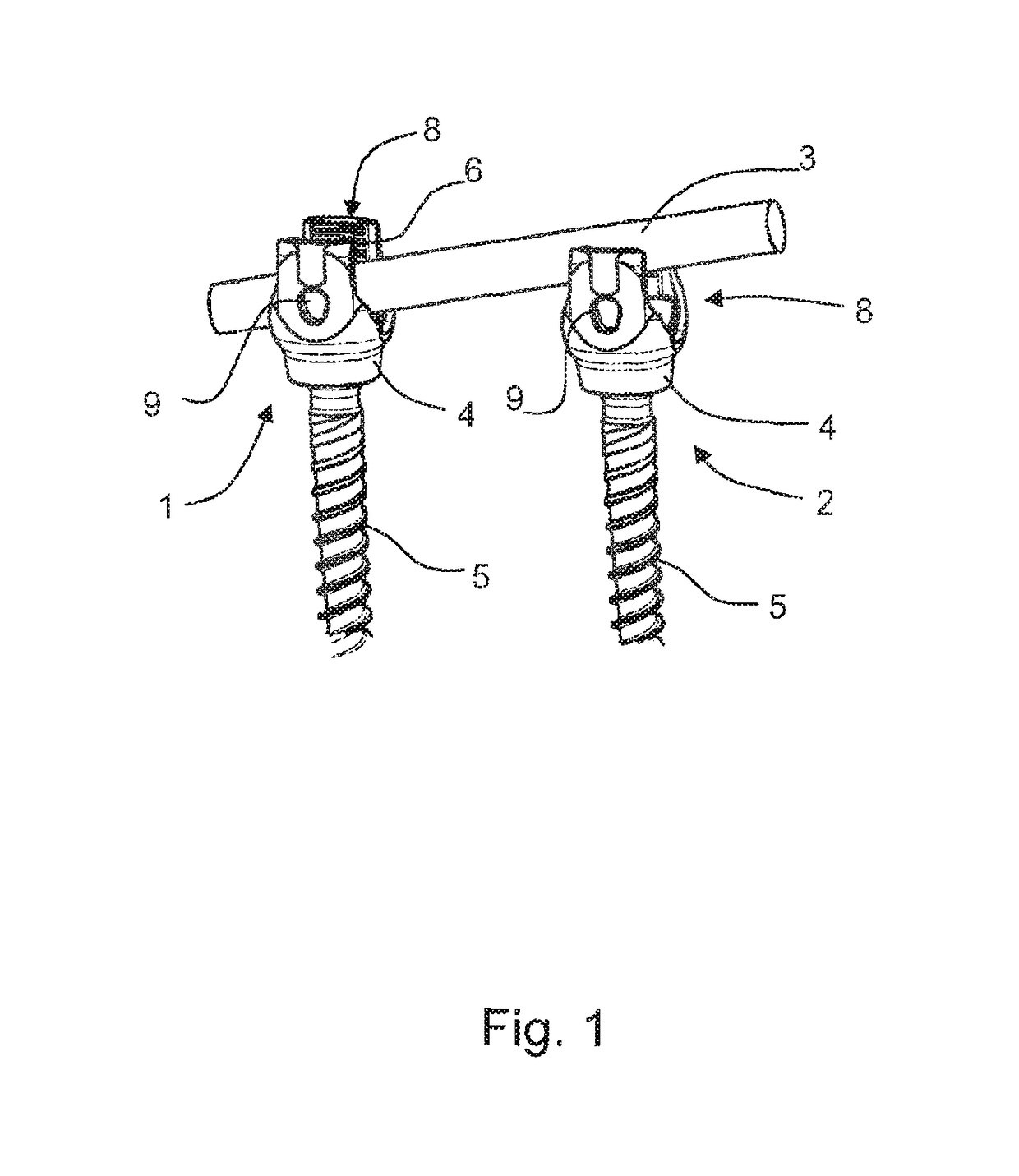 Surgical instrument for manipulating, positioning and fixing a surgical rod in relation to an implant