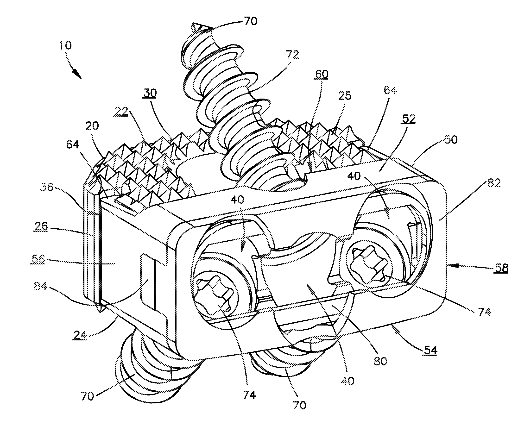 Zero-Profile Interbody Spacer and Coupled Plate Assembly