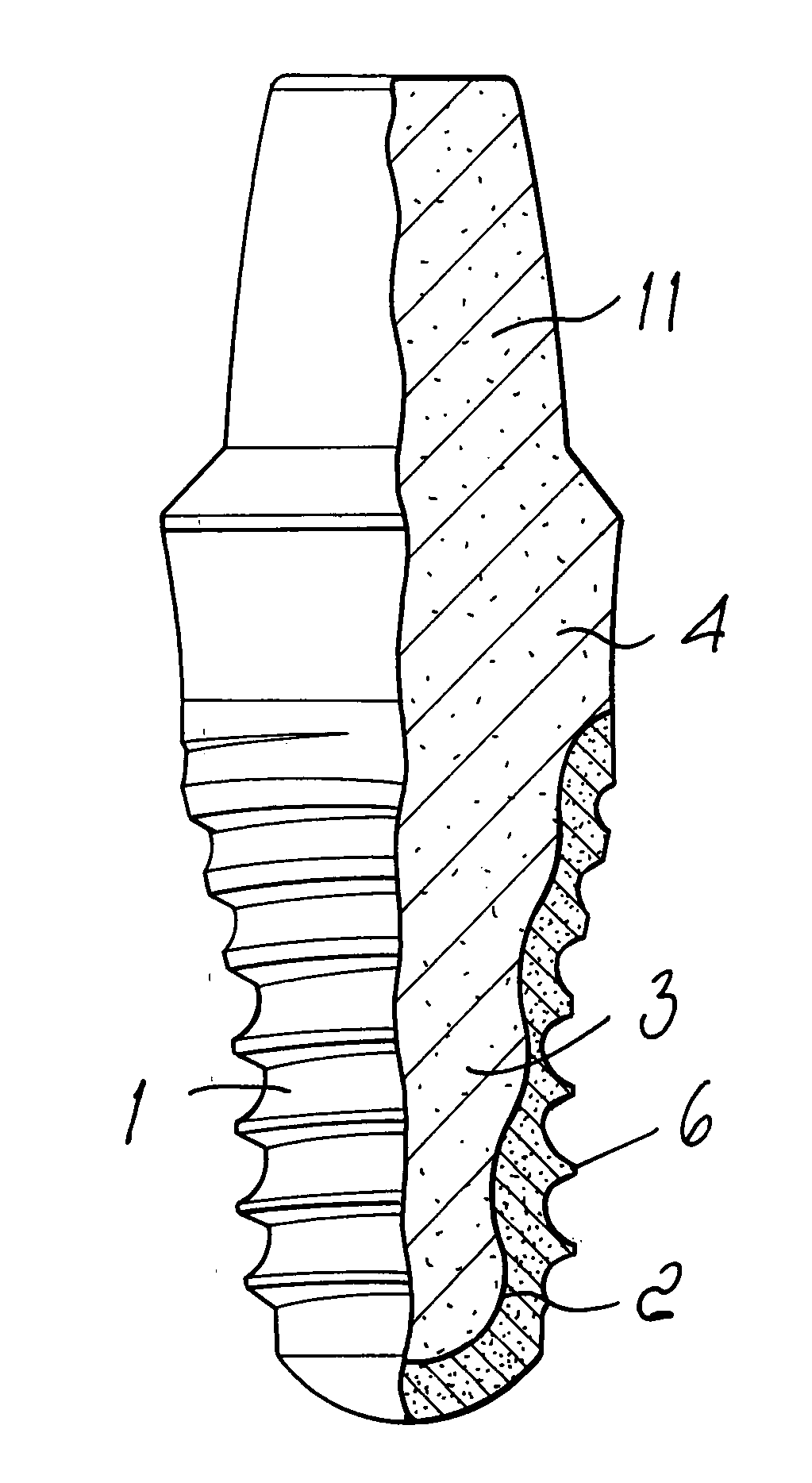 One-piece dental device and method to manufacture the same