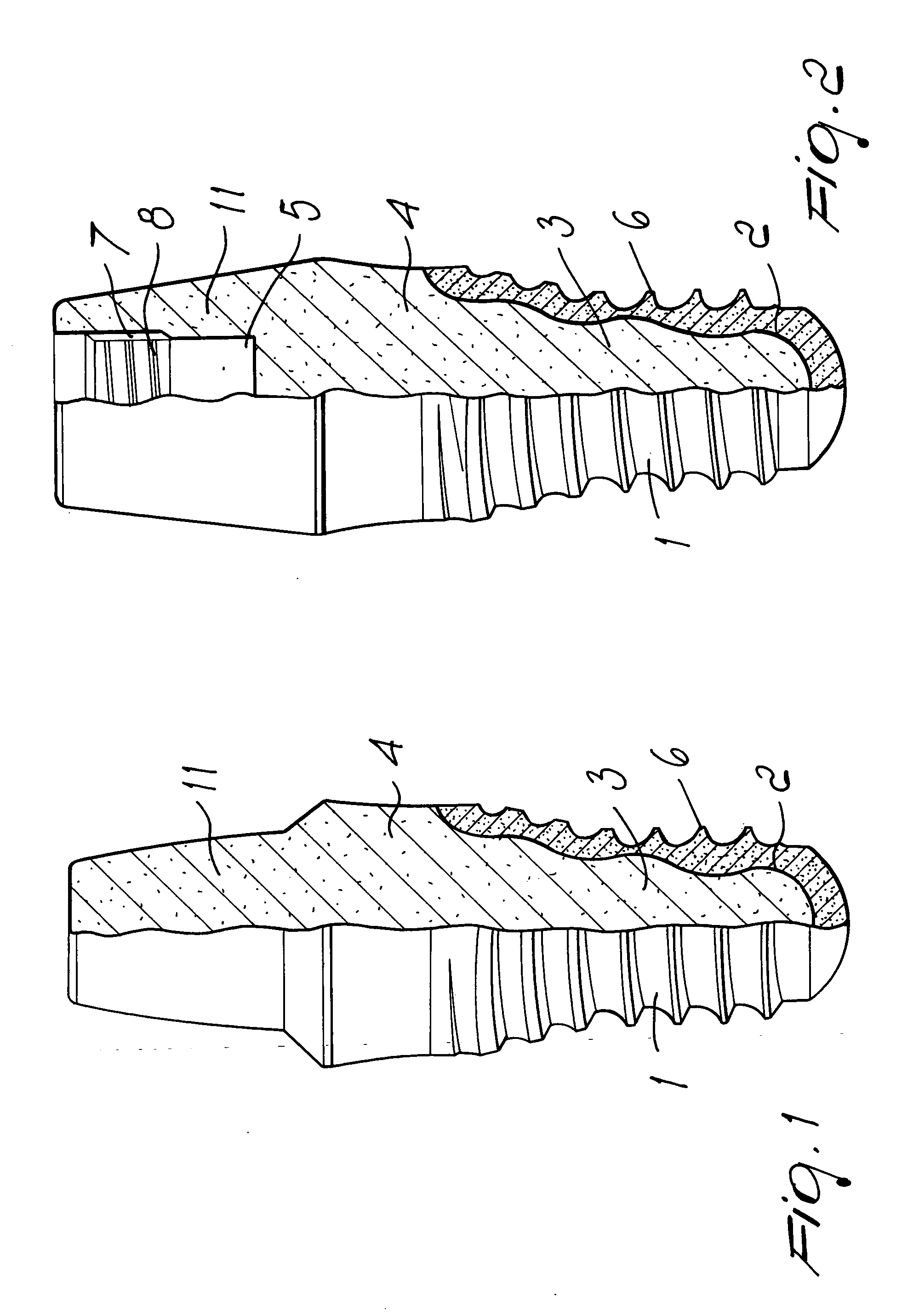 One-piece dental device and method to manufacture the same
