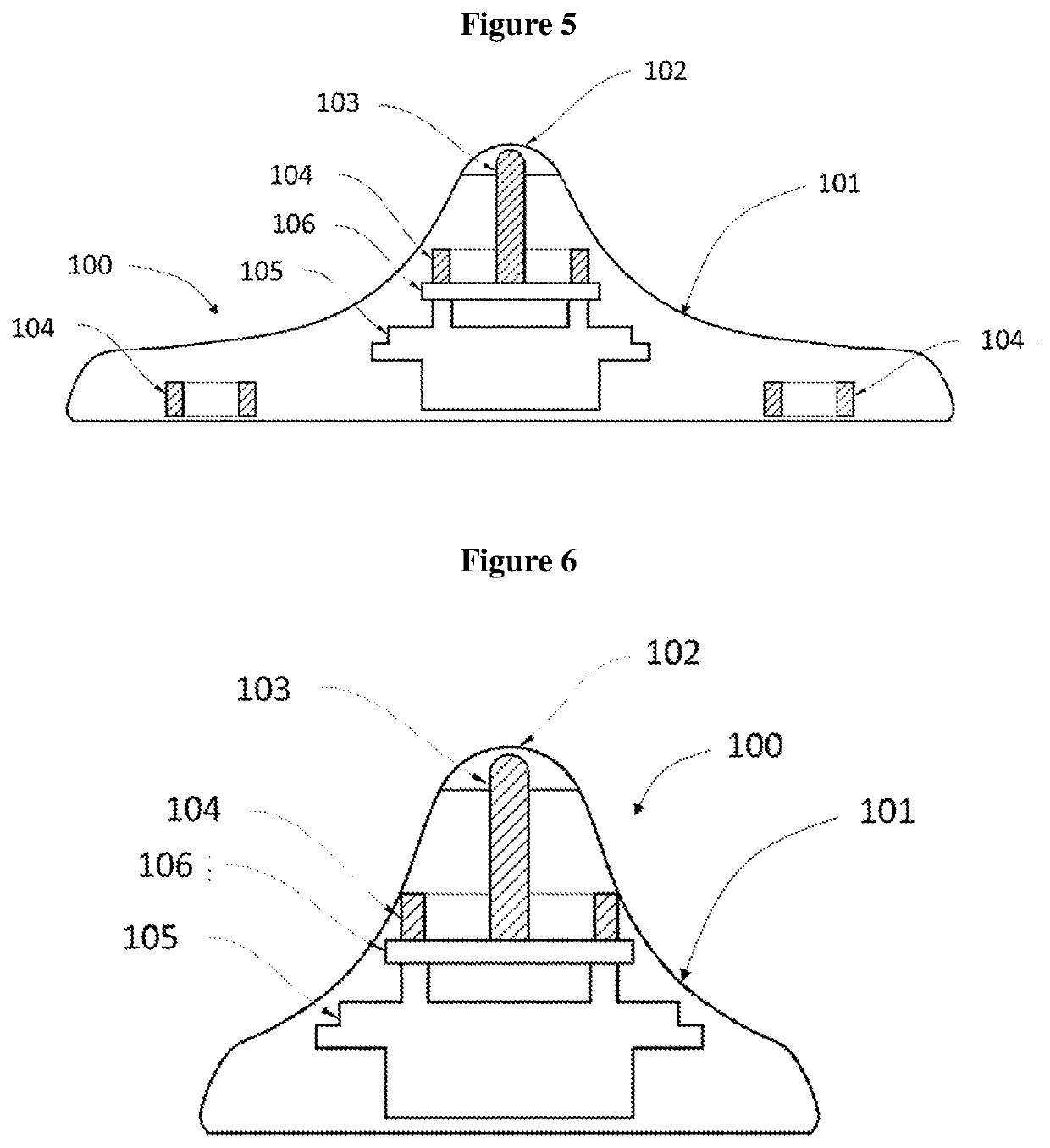 Device for acupuncture and moxibustion therapy and uses thereof