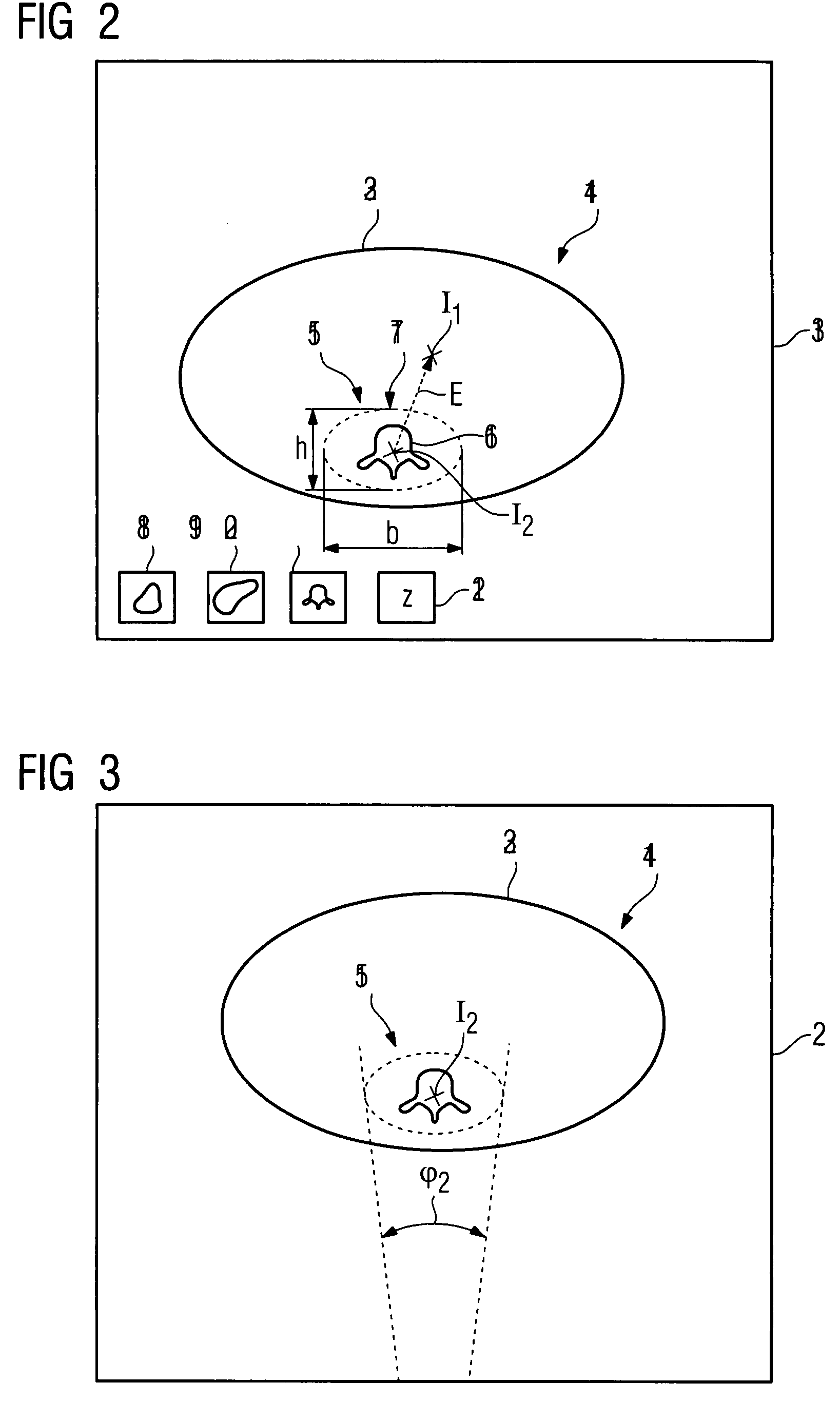 Method for recording images of a definable region of an examination object using a computed tomography facility