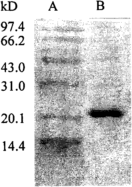 Human cytoglobin for preventing and curing cirrhosis and preparation method thereof