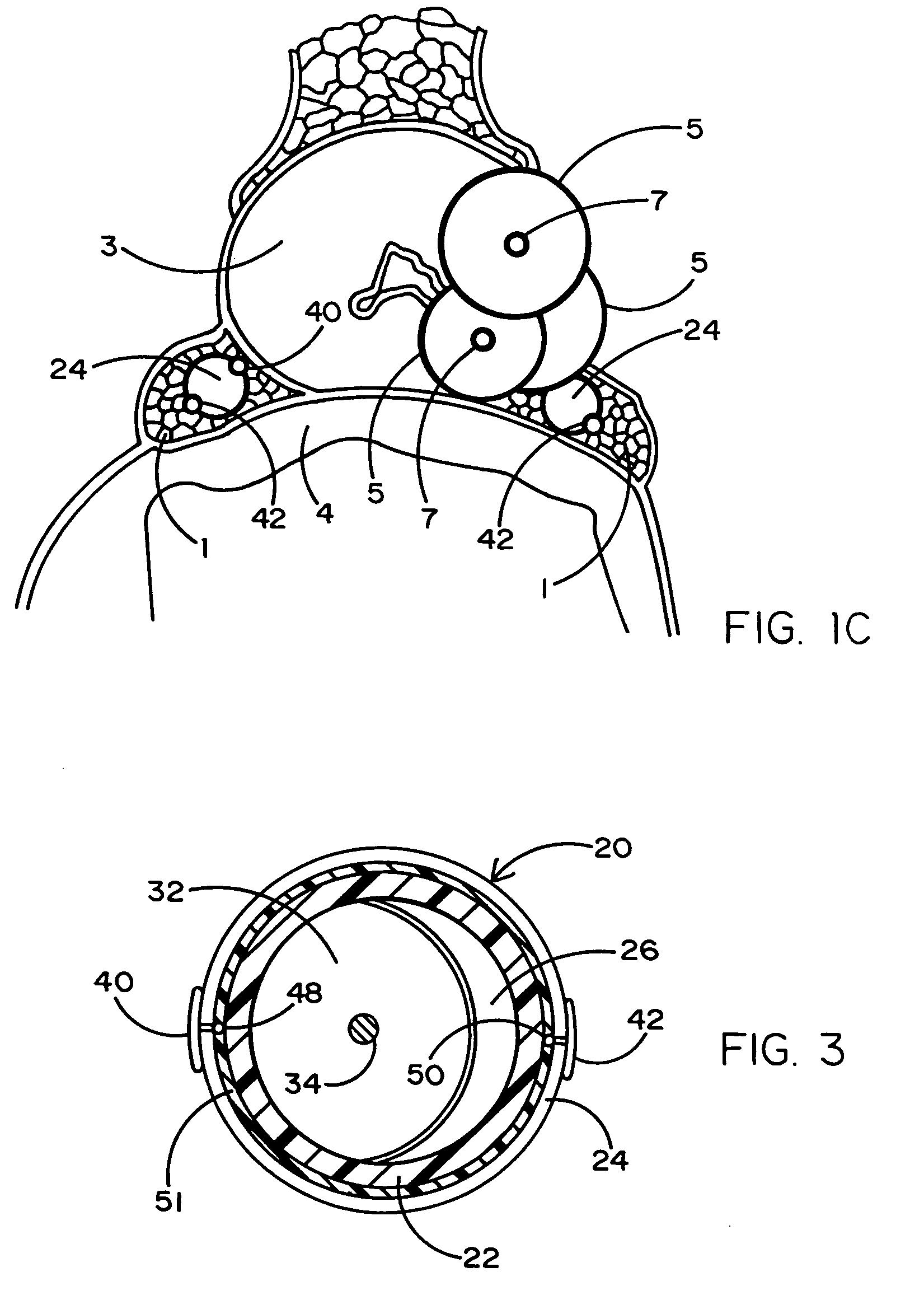 Tissue protective system and method for thermoablative therapies