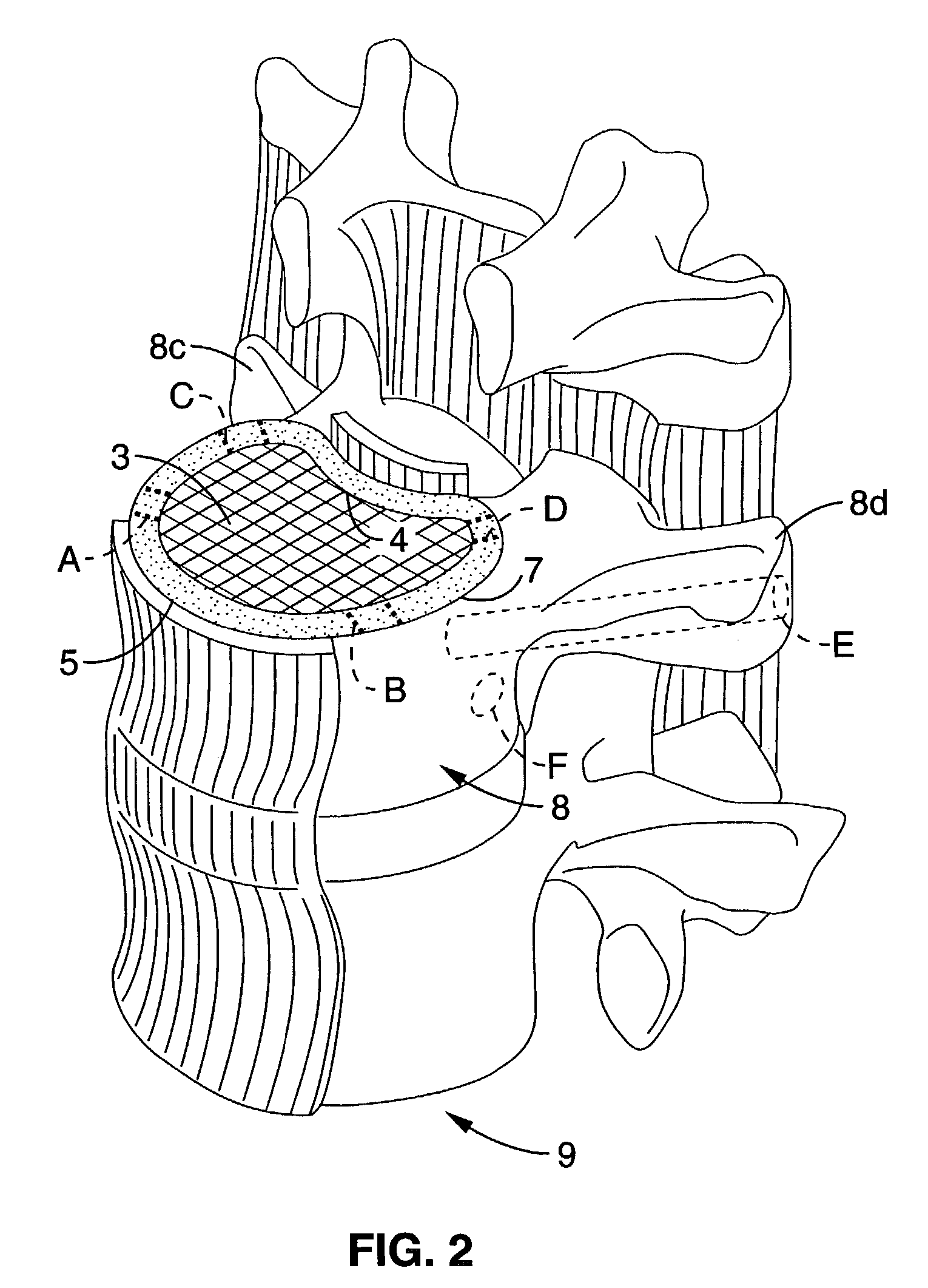 System and method providing directional ultrasound therapy to skeletal joints