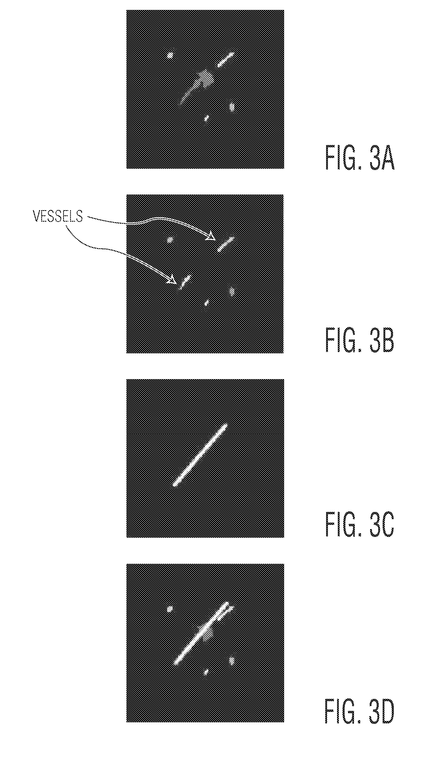 System and method for solid component evaluation in mixed ground glass nodules