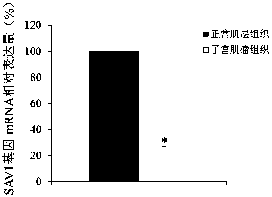 Use of SAV1 (Salvador family WW domain-containing protein 1) gene as hysteromyoma diagnostics and treatment marker