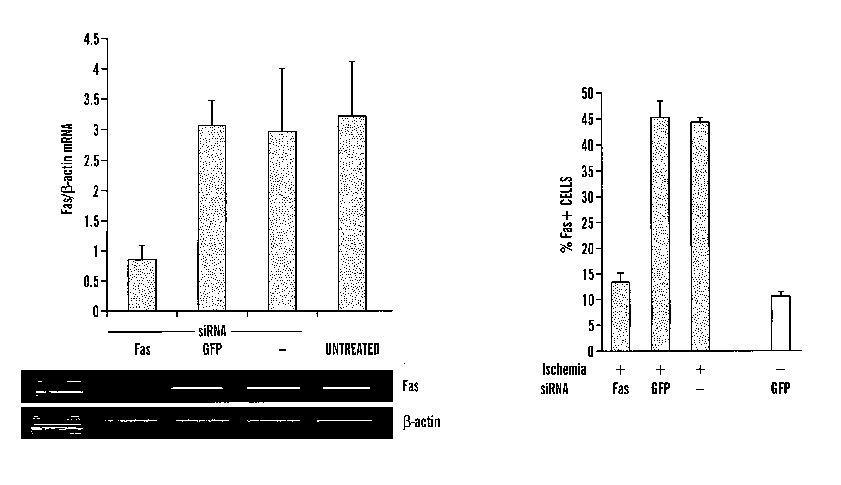 Method for Treating and Preventing Ischemia-Reperfusion Injury Using Rna Interfering Agent
