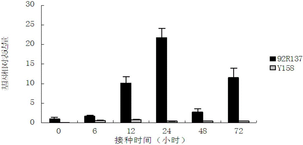 A gene tafbk1 with f-box structure domain and its expression vector and application