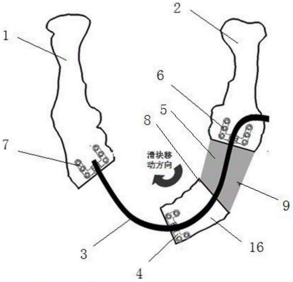 Sectional type arc-shaped distraction osteogenesis device