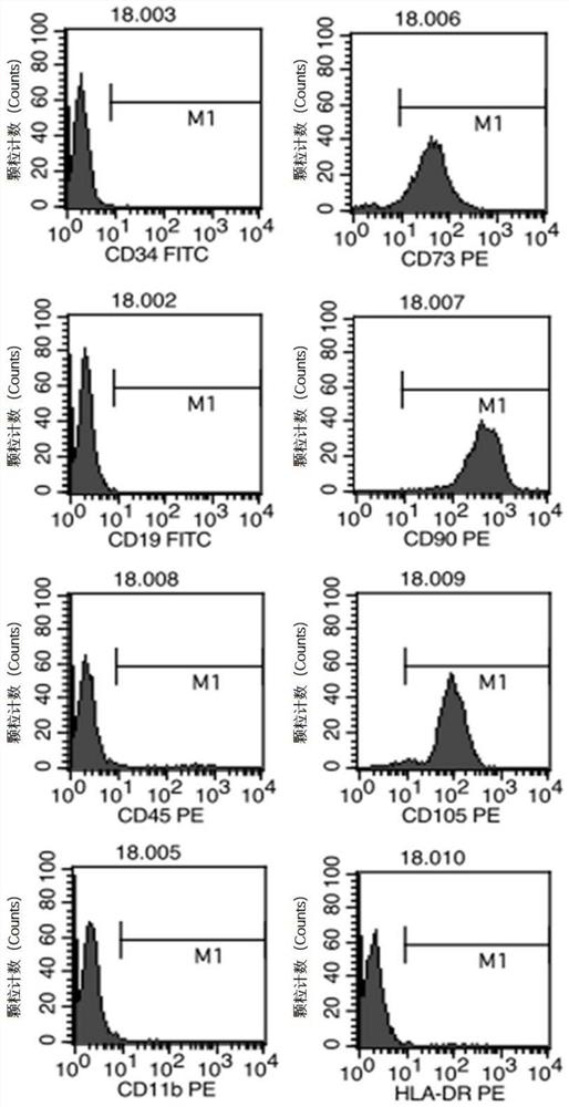 A mesenchymal stem cell for inhibiting tumor growth, preparation method and application thereof