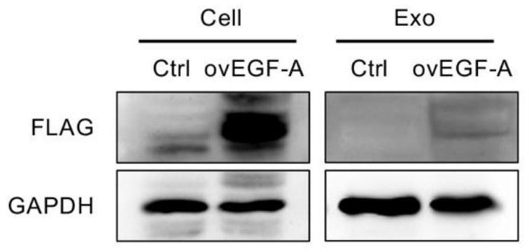 Recombinant gene, vector and exosome for double-way antagonism of PCSK9 as well as preparation method and application of exosome