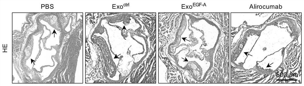 Recombinant gene, vector and exosome for double-way antagonism of PCSK9 as well as preparation method and application of exosome