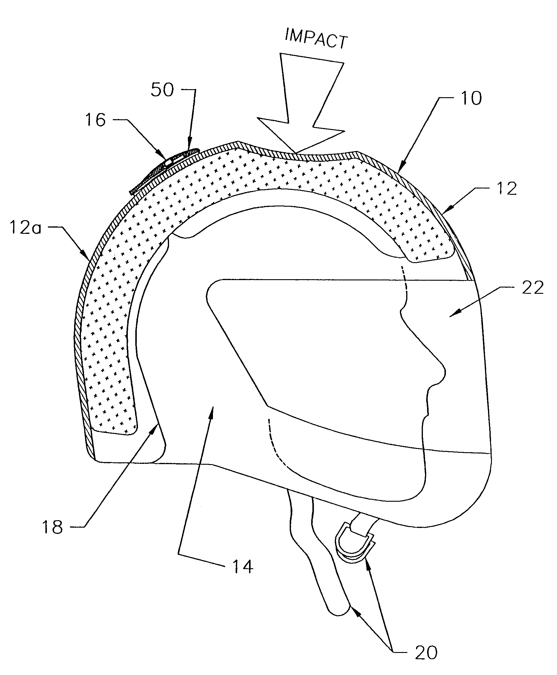 Helmet with shock detector, helmet attachment device with shock detector and methods