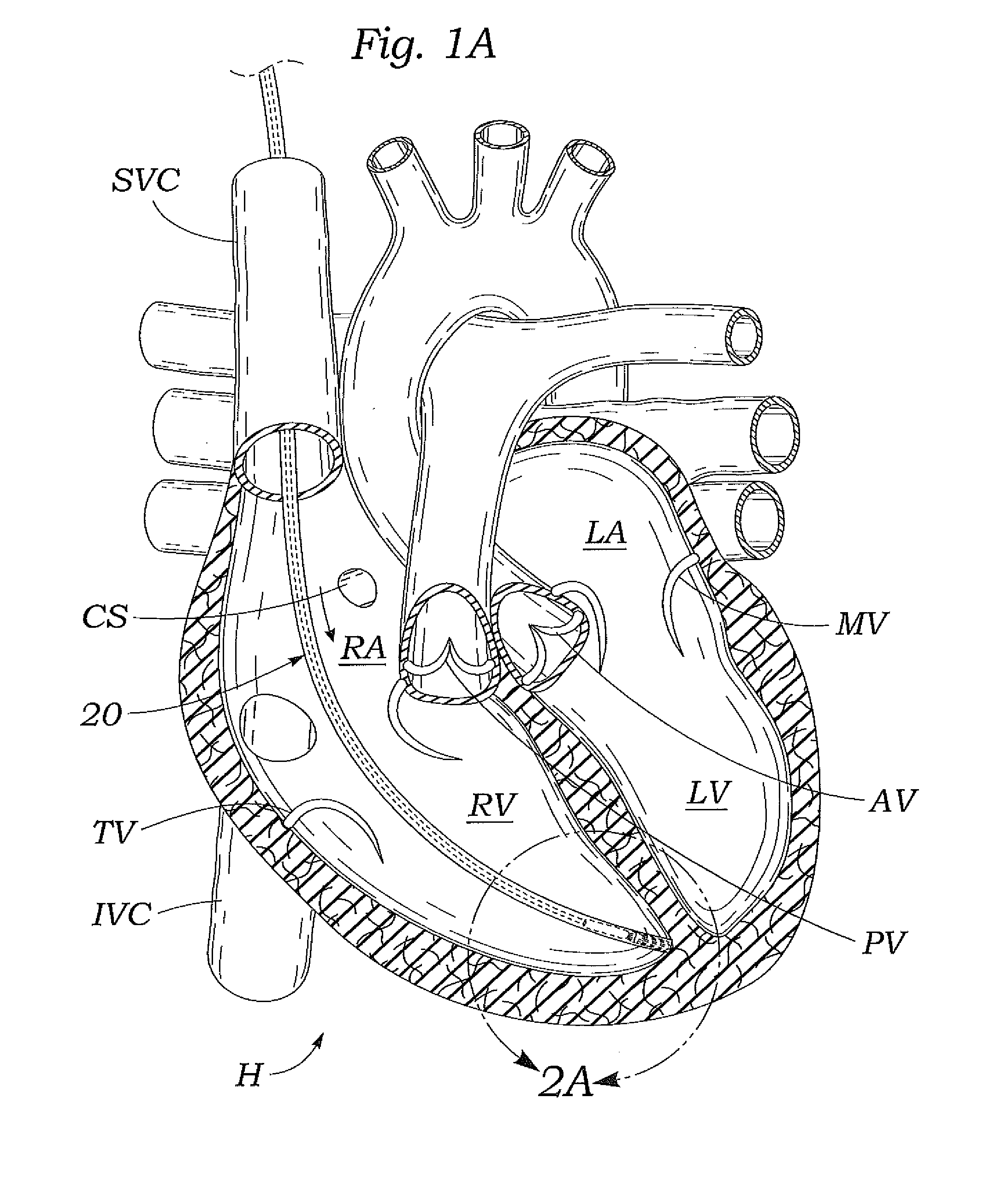 Systems and methods for placing a coapting member between valvular leaflets