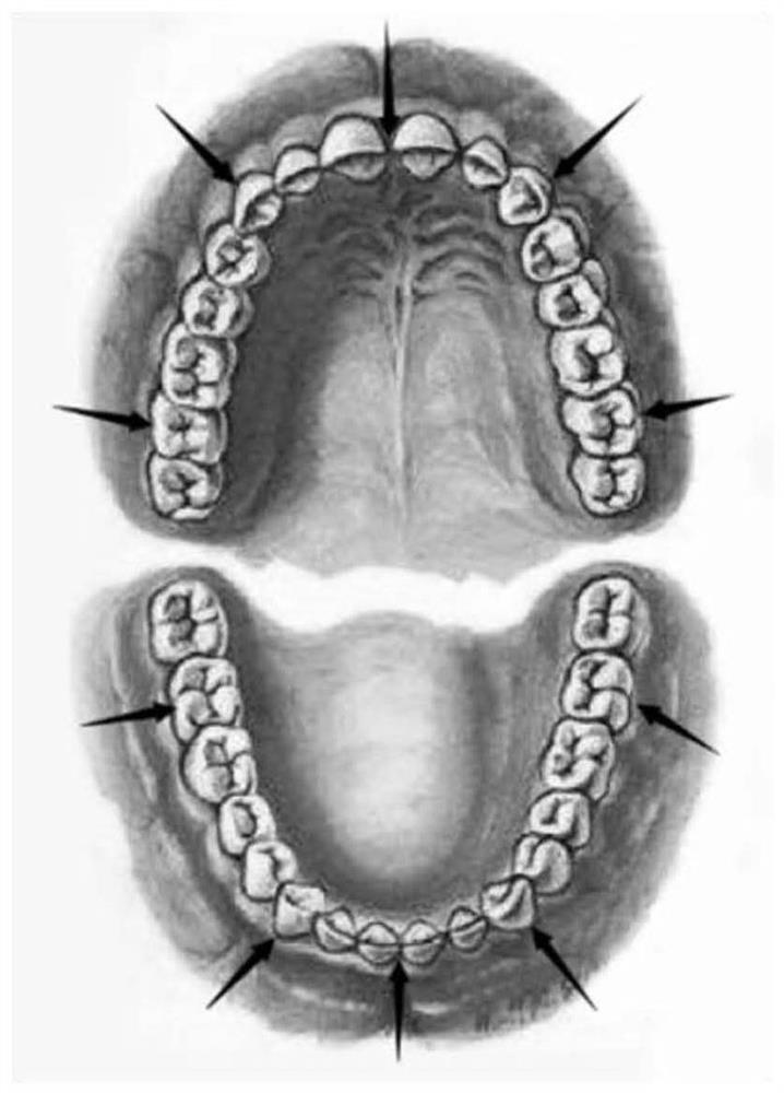 A digital model intelligent design method for dental digital impression apparatus