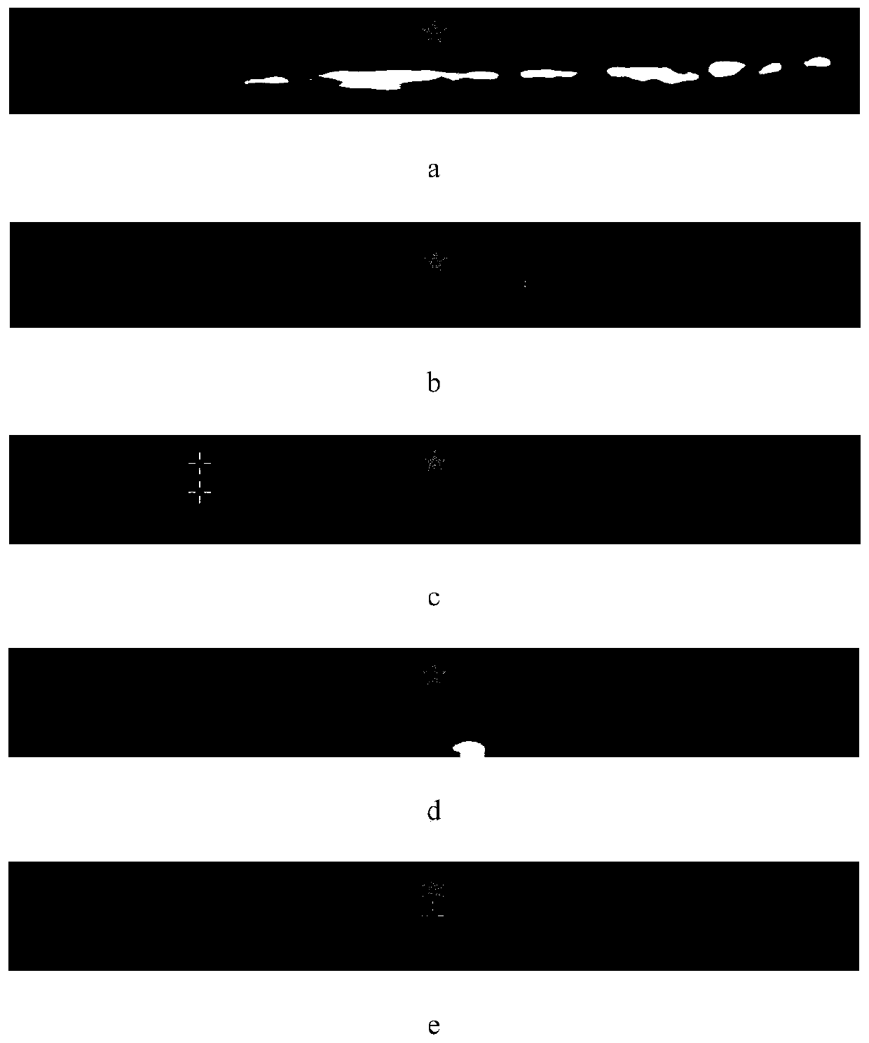 Ultrasonic carotid artery distal recognition device and method based on convolutional neural network