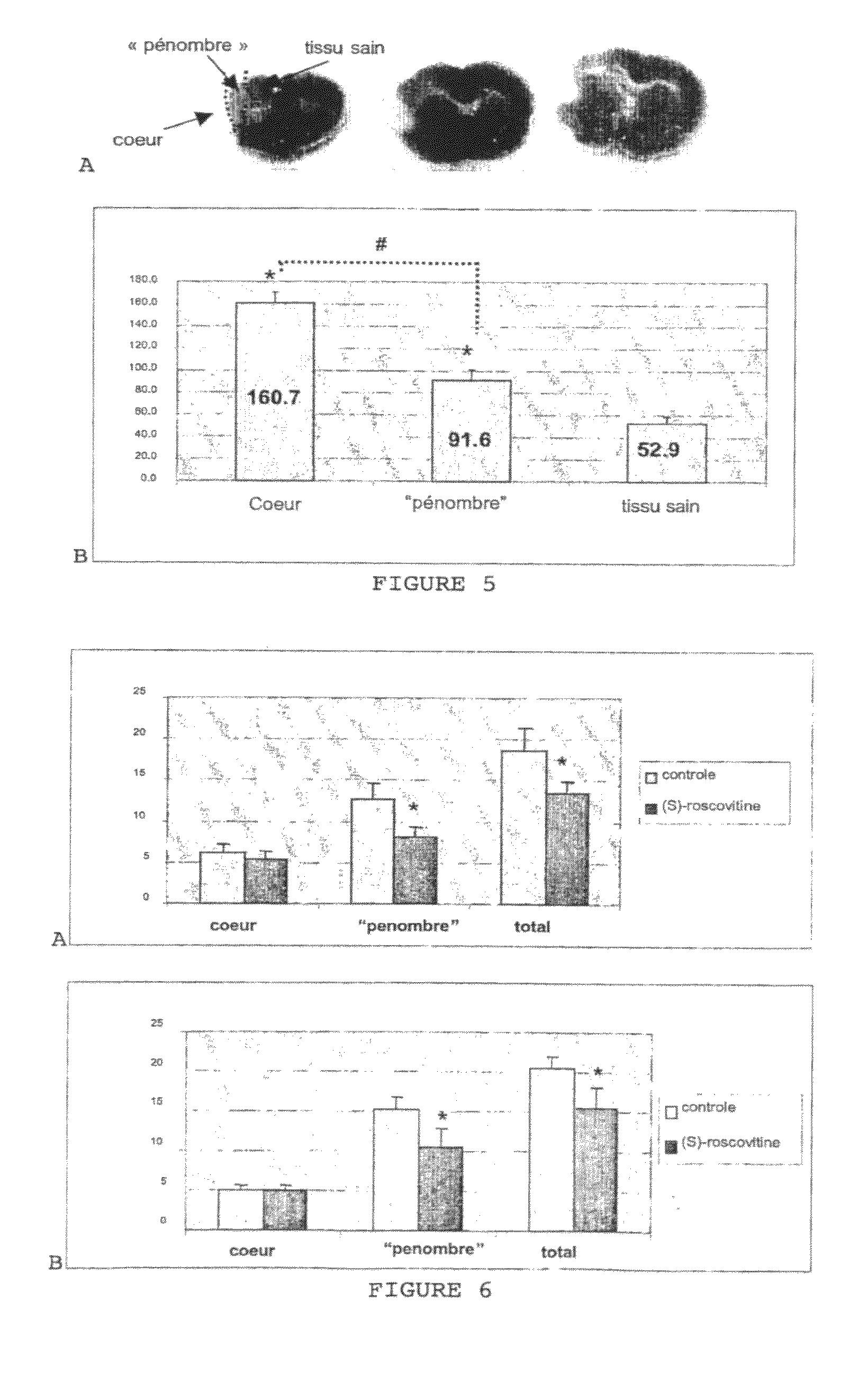 Administration of (S)-roscovitine for protection against and/or treatment of neurological diseases