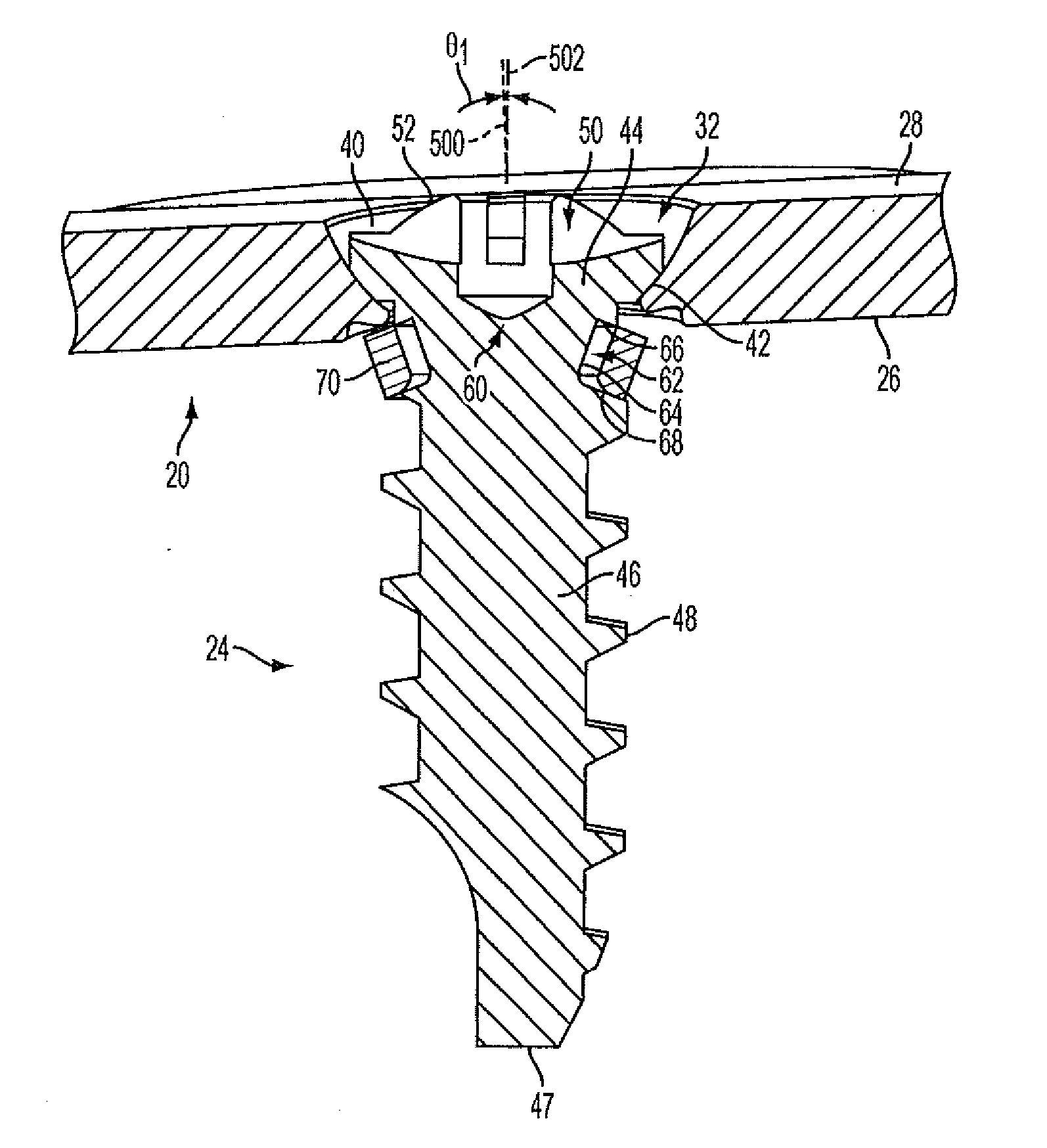 Fixation plate screw retention