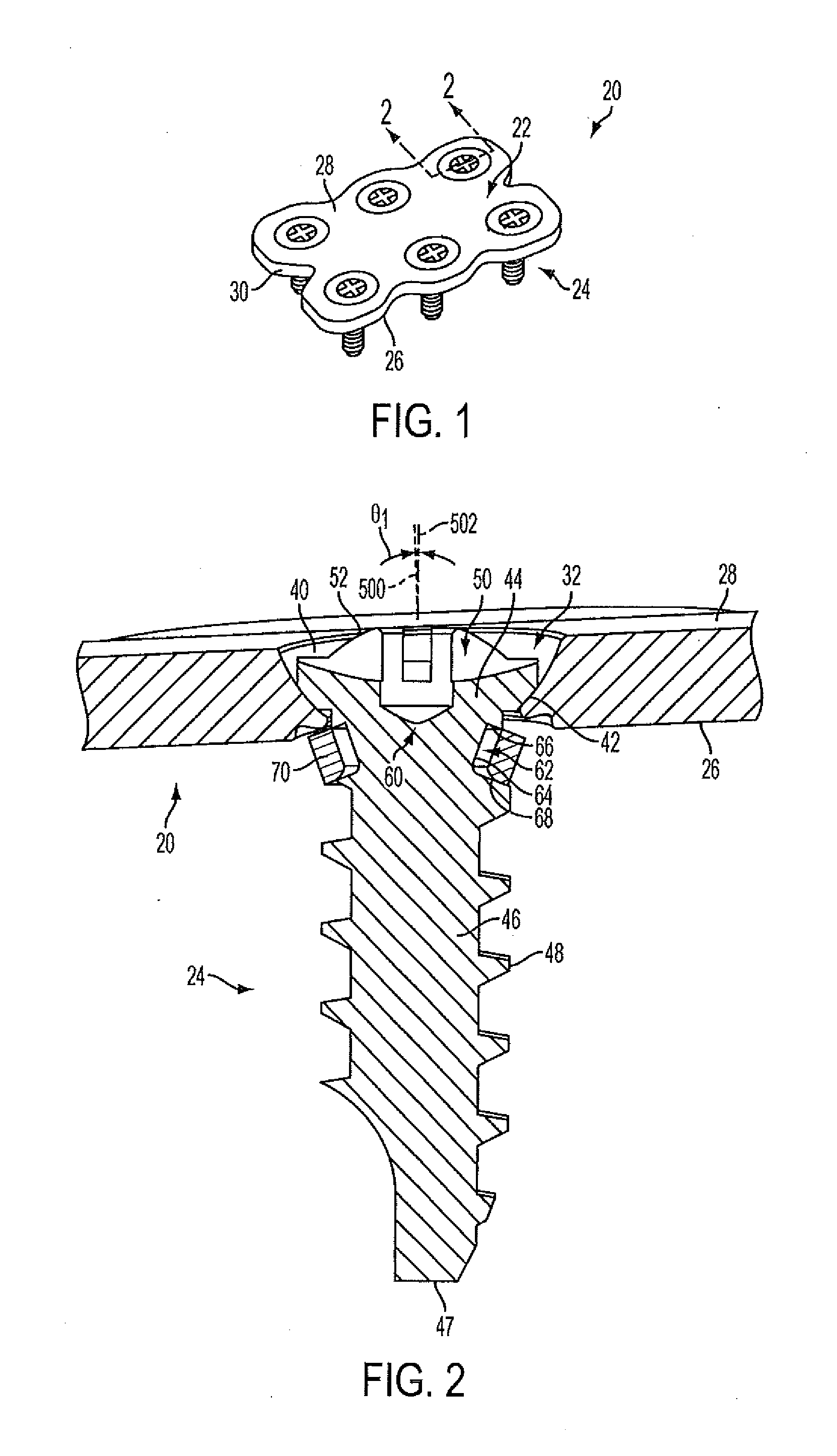 Fixation plate screw retention