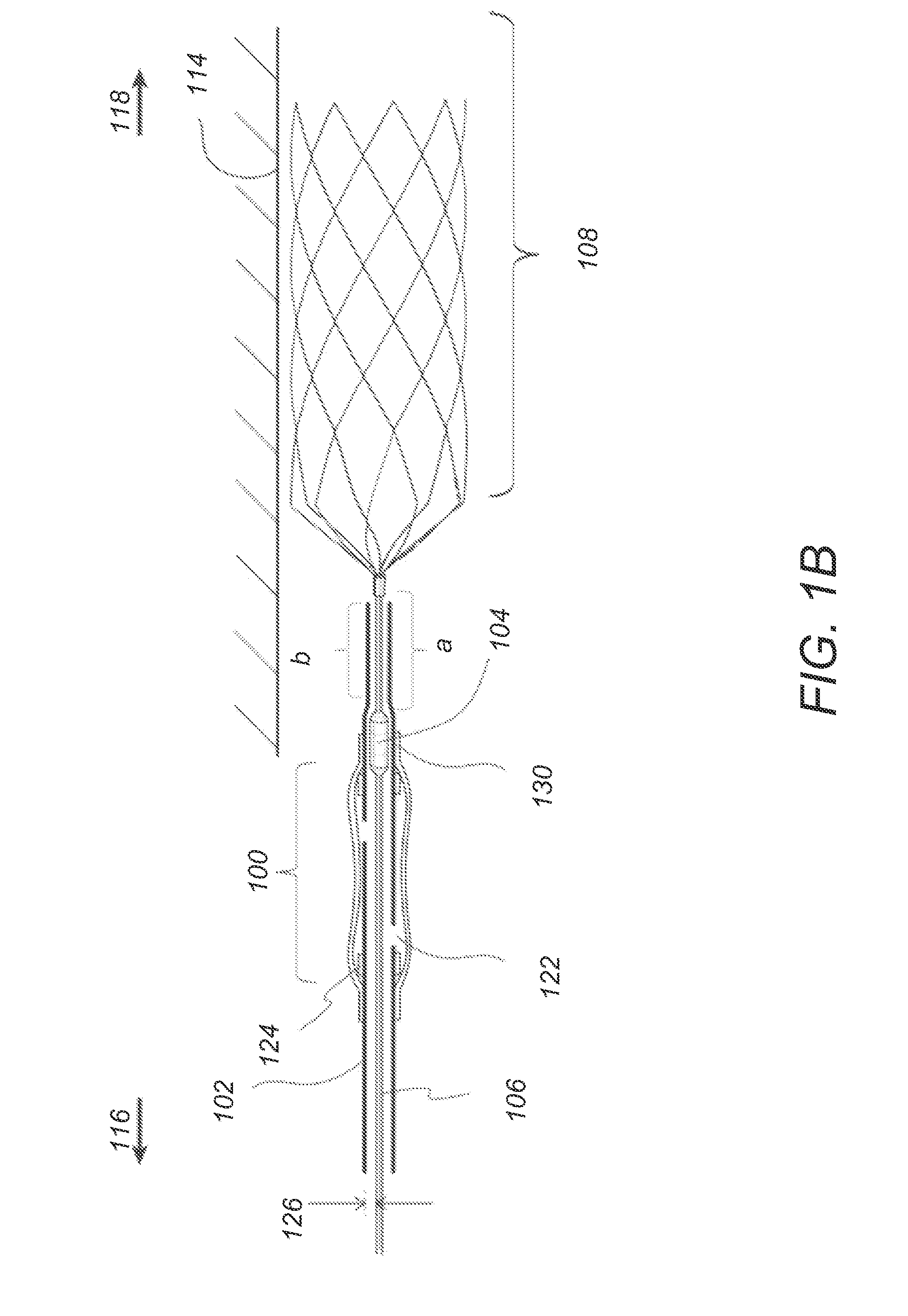 Methods, devices, and systems for postconditioning with clot removal