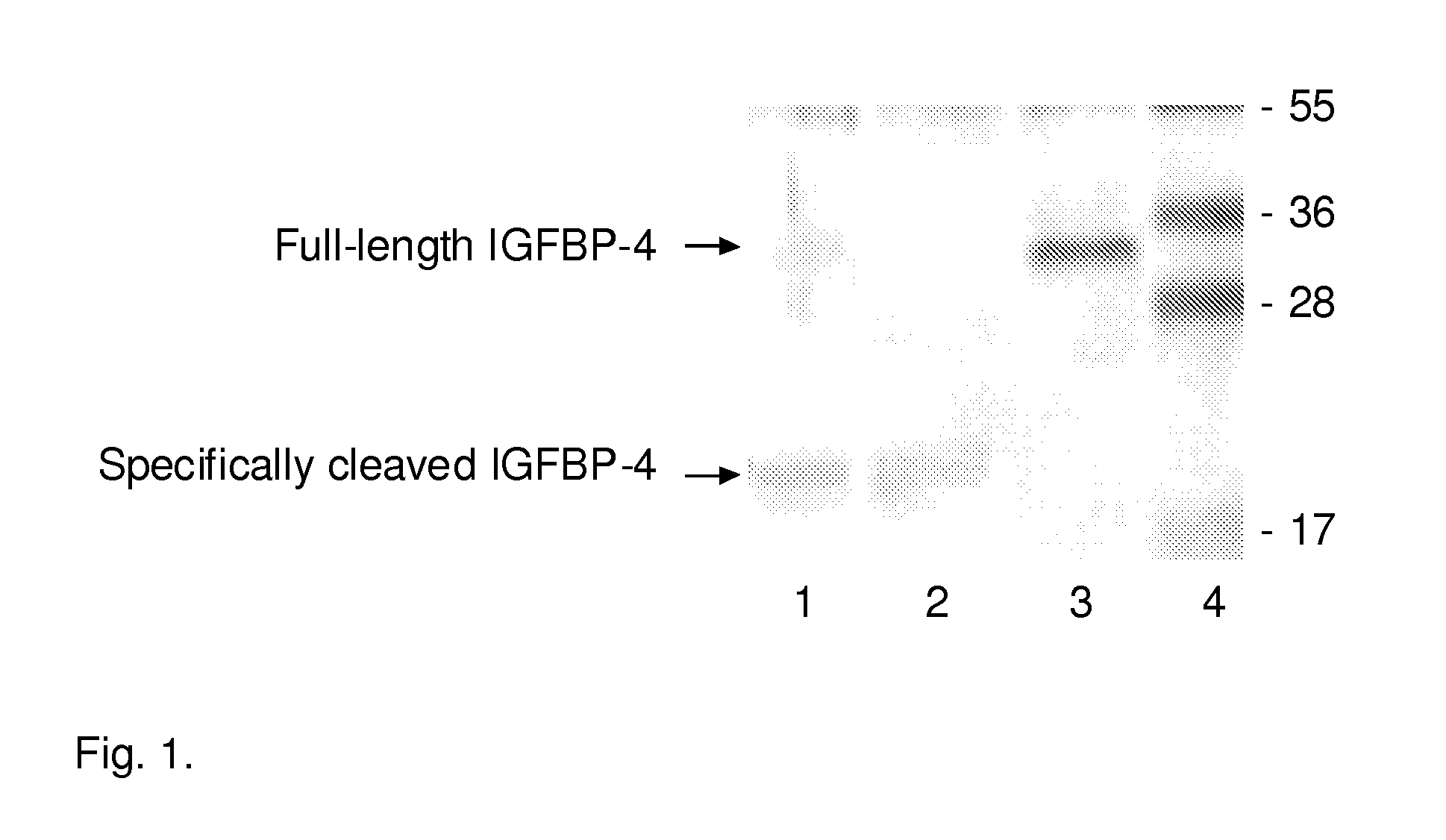 Diagnostic kit for IGFBP-4 proteolytic fragments in a patient sample
