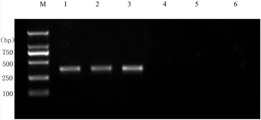 Detection primer for wolbachia in small brown rice planthopper as well as detection method and detection kit thereof