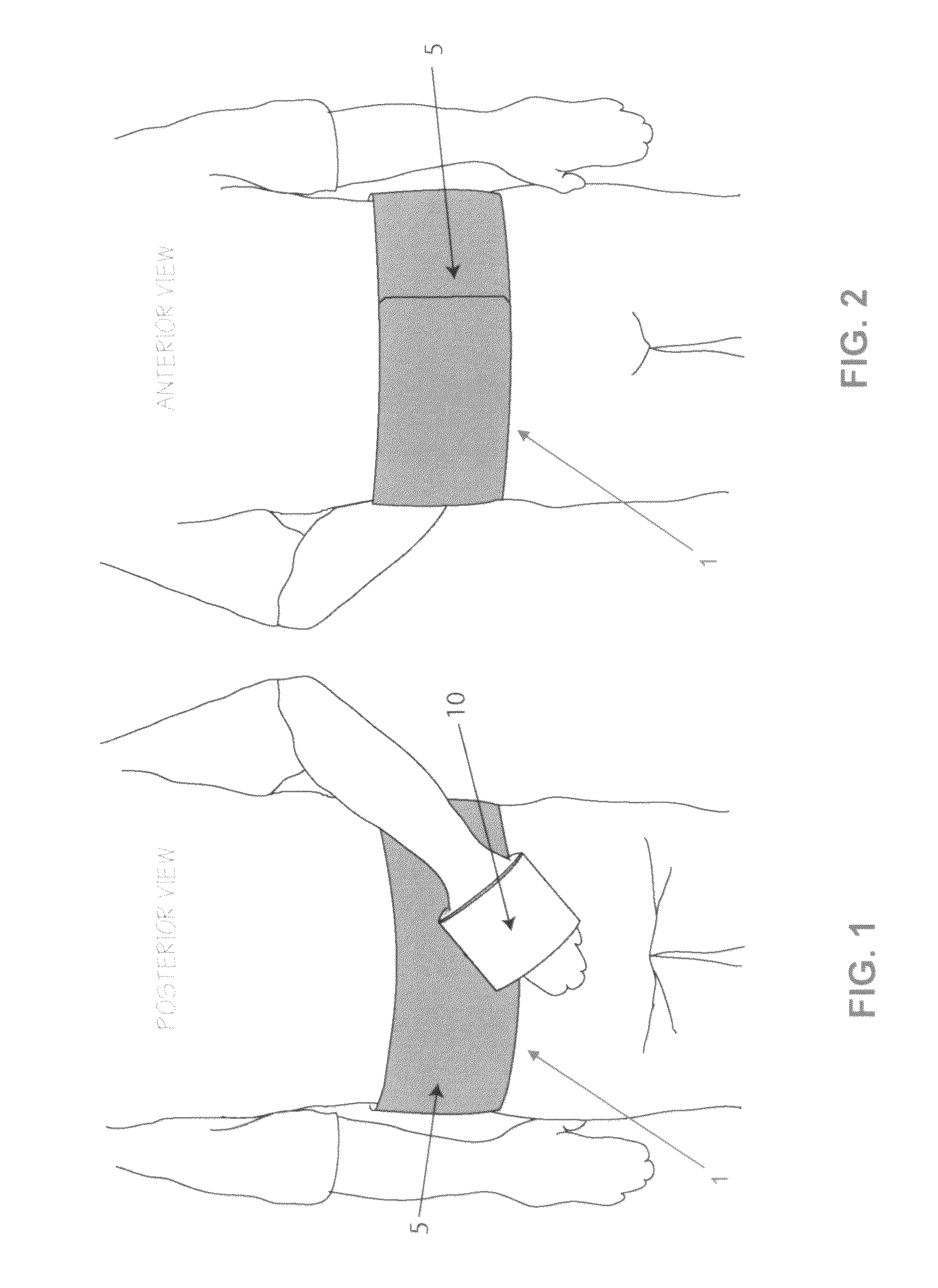 Method and apparatus for therapeutically supporting the arm of a patient