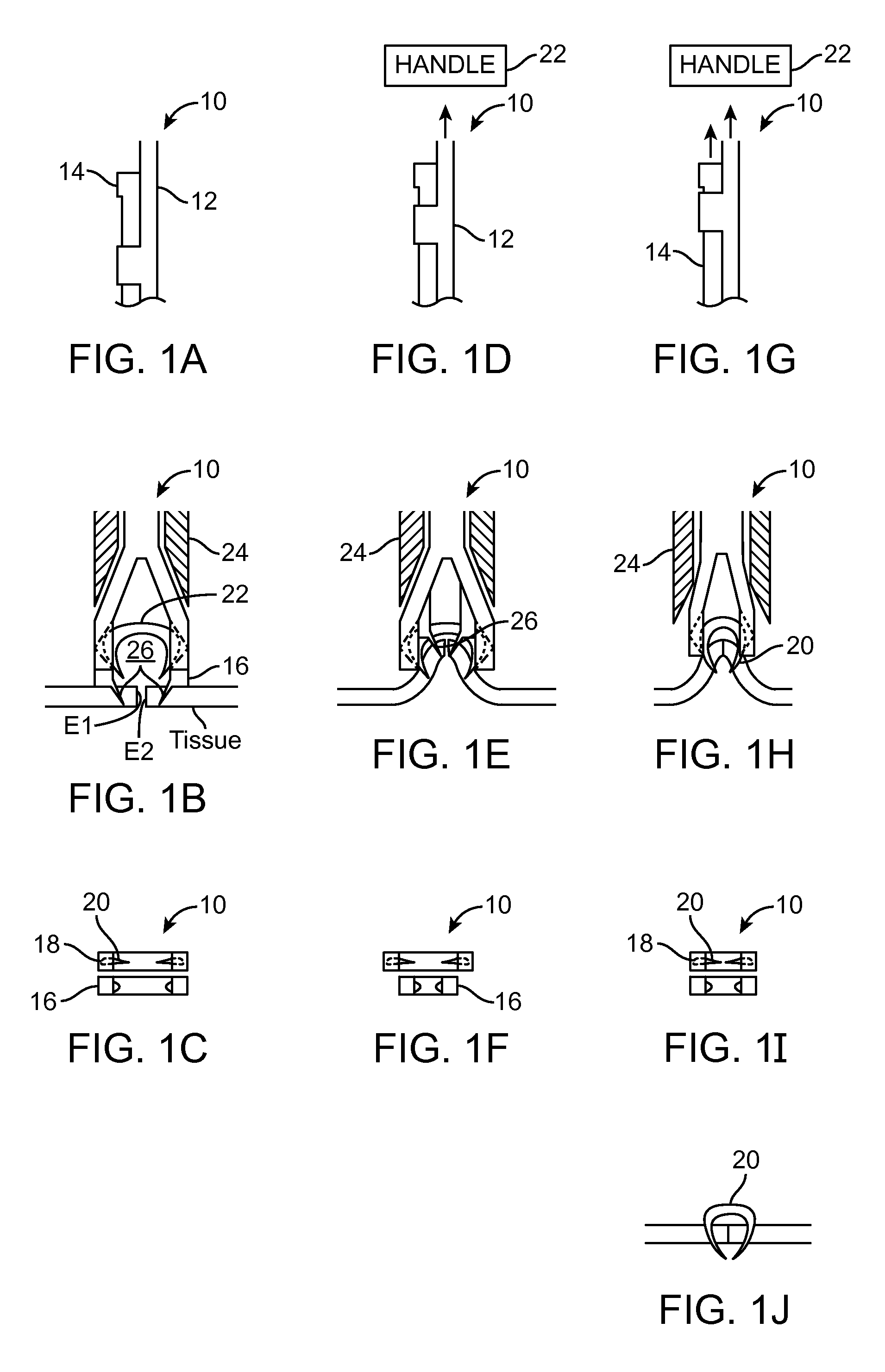 Fasteners, deployment systems, and methods for ophthalmic tissue closure and fixation of ophthalmic prostheses and other uses