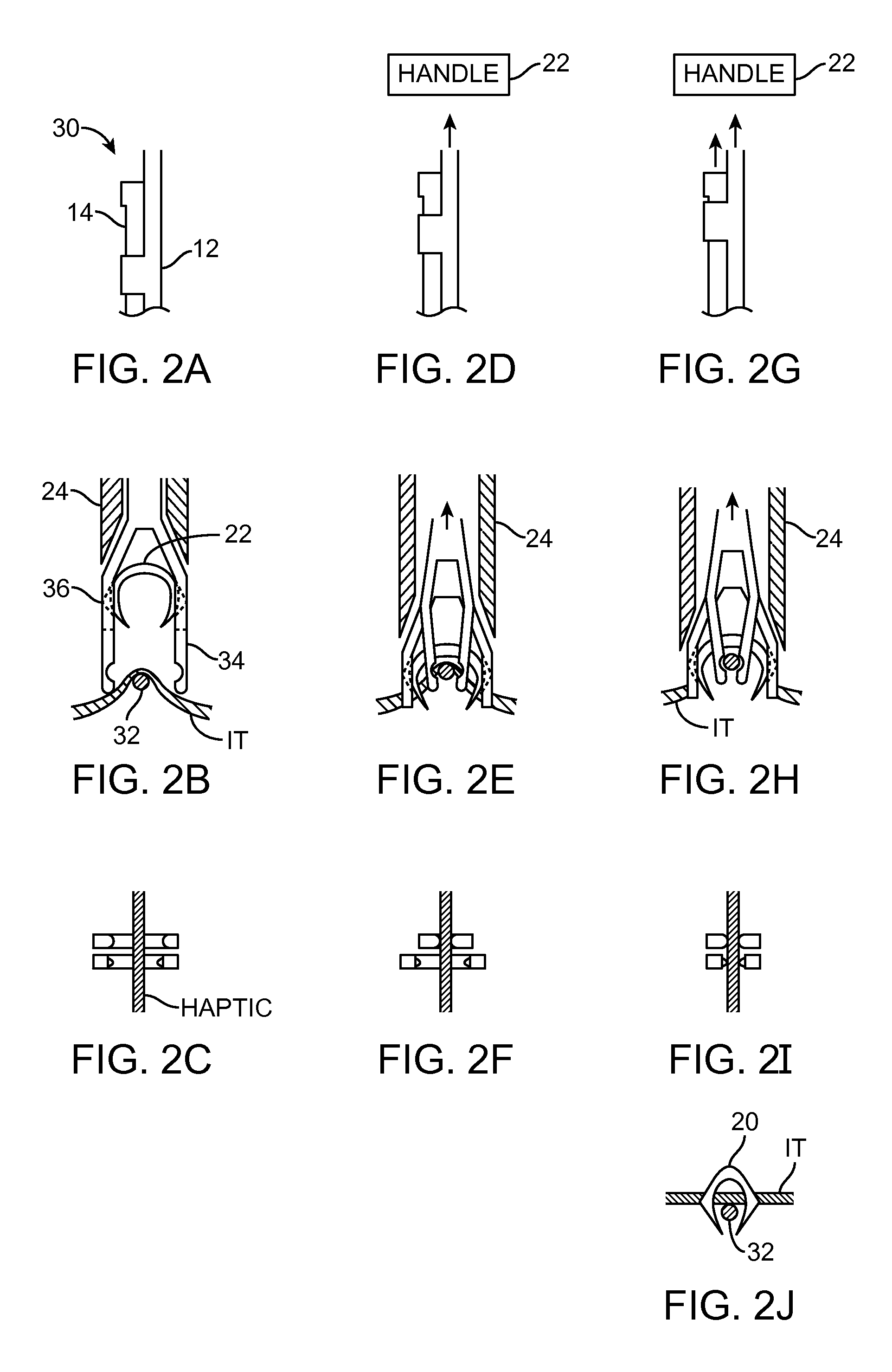 Fasteners, deployment systems, and methods for ophthalmic tissue closure and fixation of ophthalmic prostheses and other uses