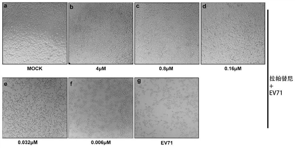 Application of lapatinib and/or medicinal derivatives thereof in preparation of anti-enterovirus drugs