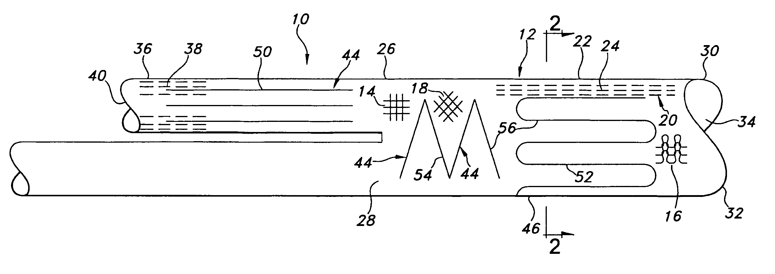 Hybrid vascular graft reinforcement