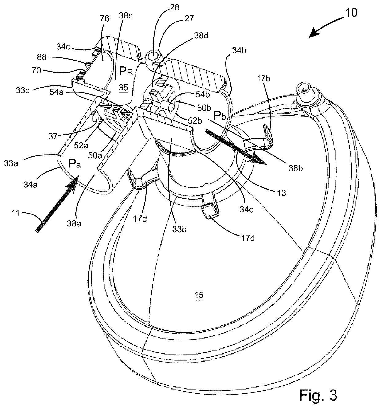 Methods of respiratory support and related apparatus