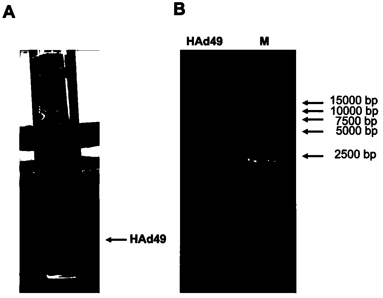 Recombinant adenovirus expression vector based on adenovirus HAd49 and construction method thereof