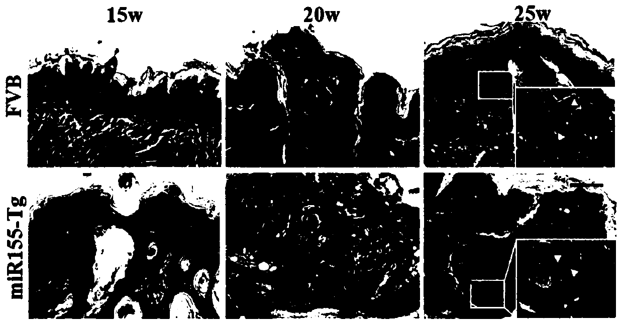 Construction method of miR155 overexpression mouse tongue squamous cell cancer model