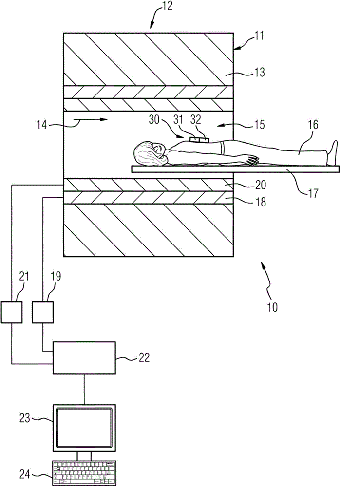 Method and device for wireless transmission of acoustic cardiac signals