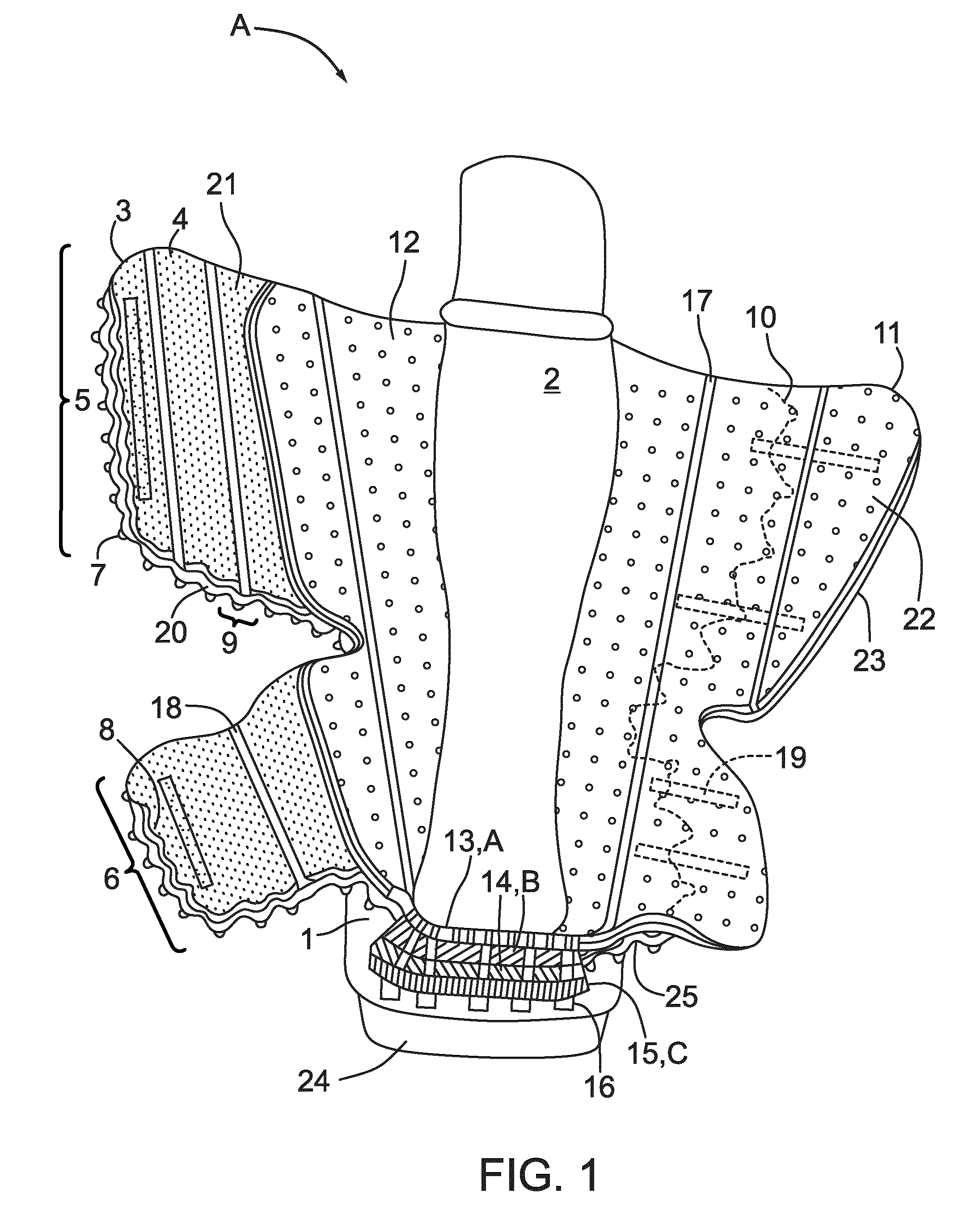 Porous orthopedic or prosthetic support having removable cushioning and scaffolding layers