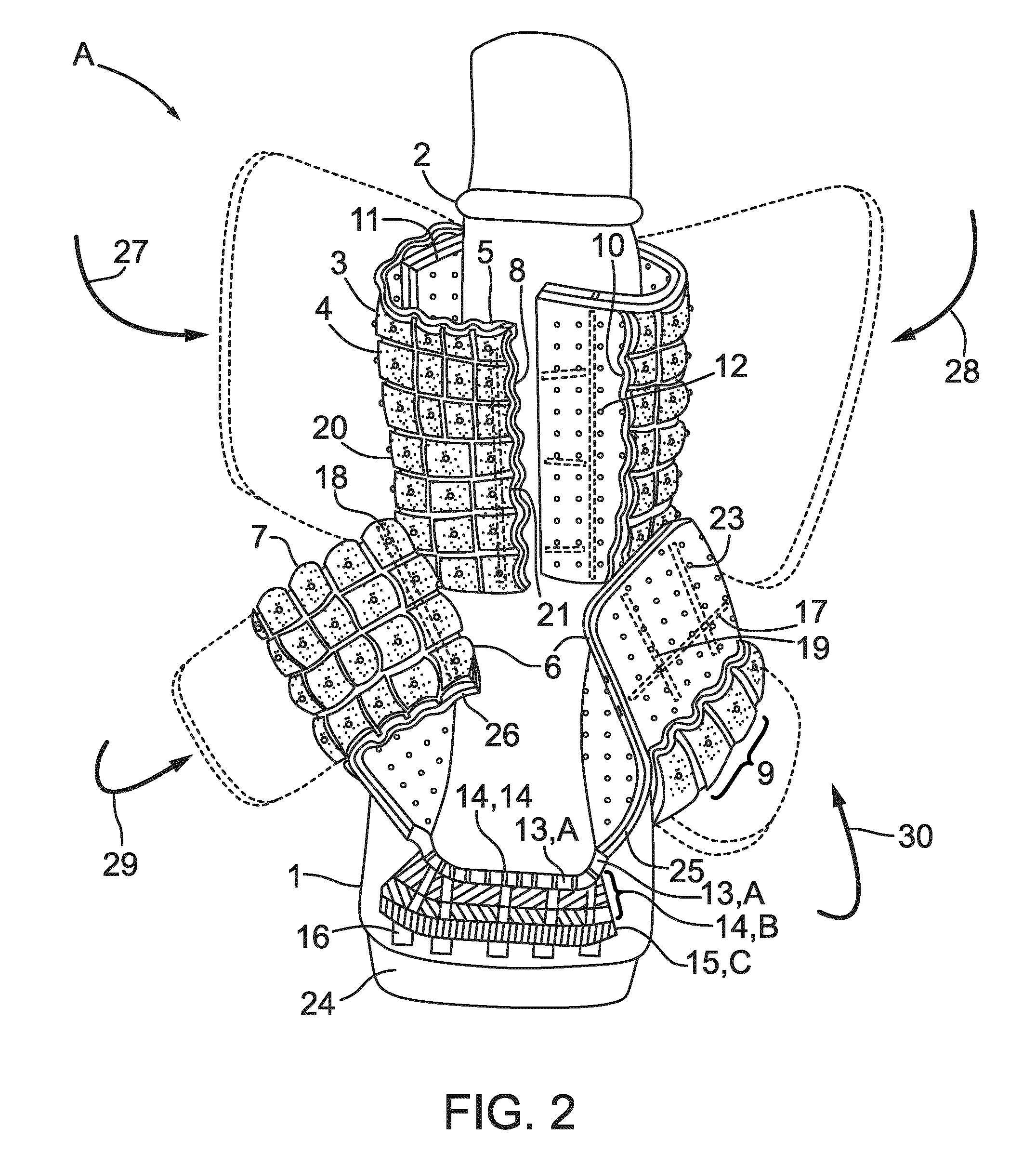 Porous orthopedic or prosthetic support having removable cushioning and scaffolding layers