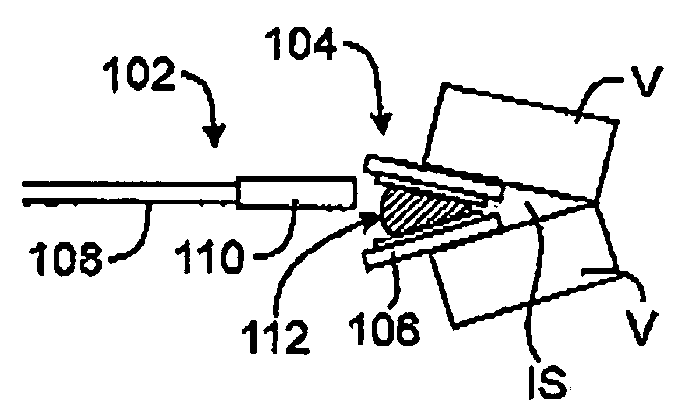 Methods and apparatus for intervertebral disc prosthesis insertion